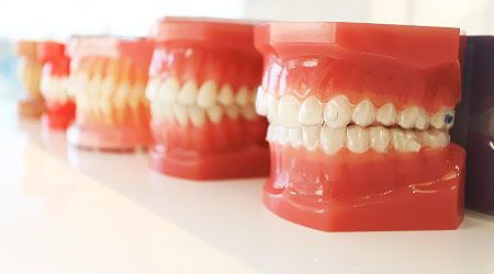 あなたに合った自然な歯並び