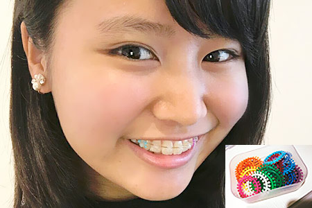 魅せる矯正治療も好評です